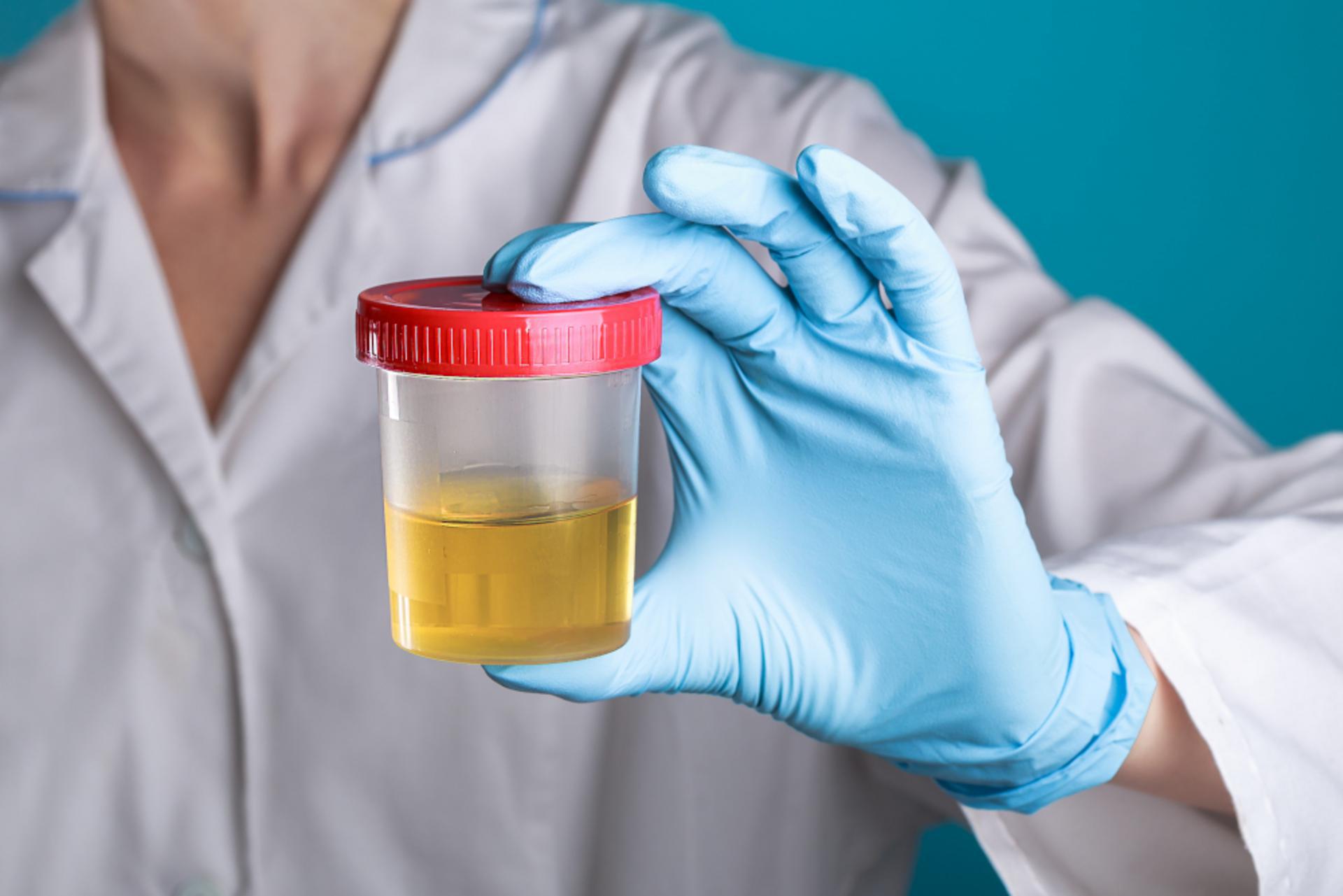 How Instant Drug Tests Can Speed Up Your Hiring Process - 