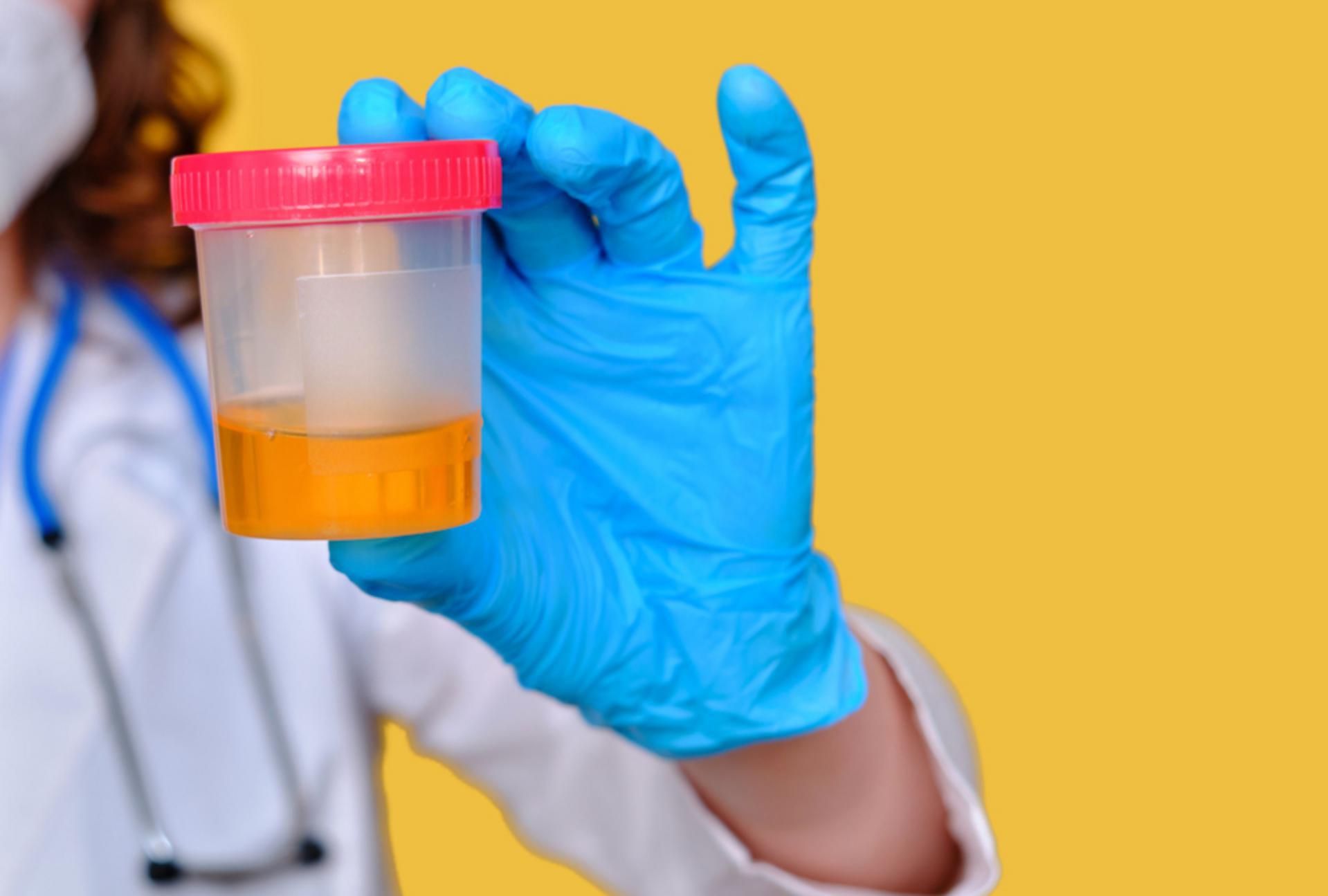 Reasons to Have a Random Drug Testing Policy - featured