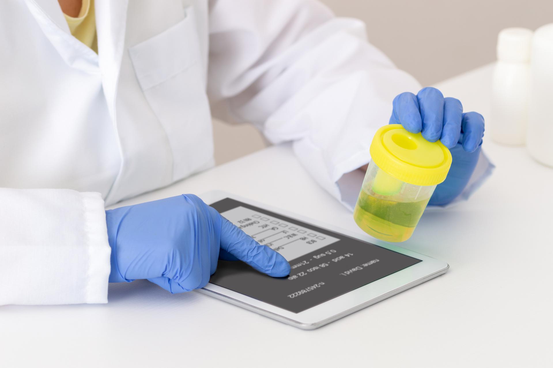 What are the Guidelines for Drug Testing in the Workplace? - featured