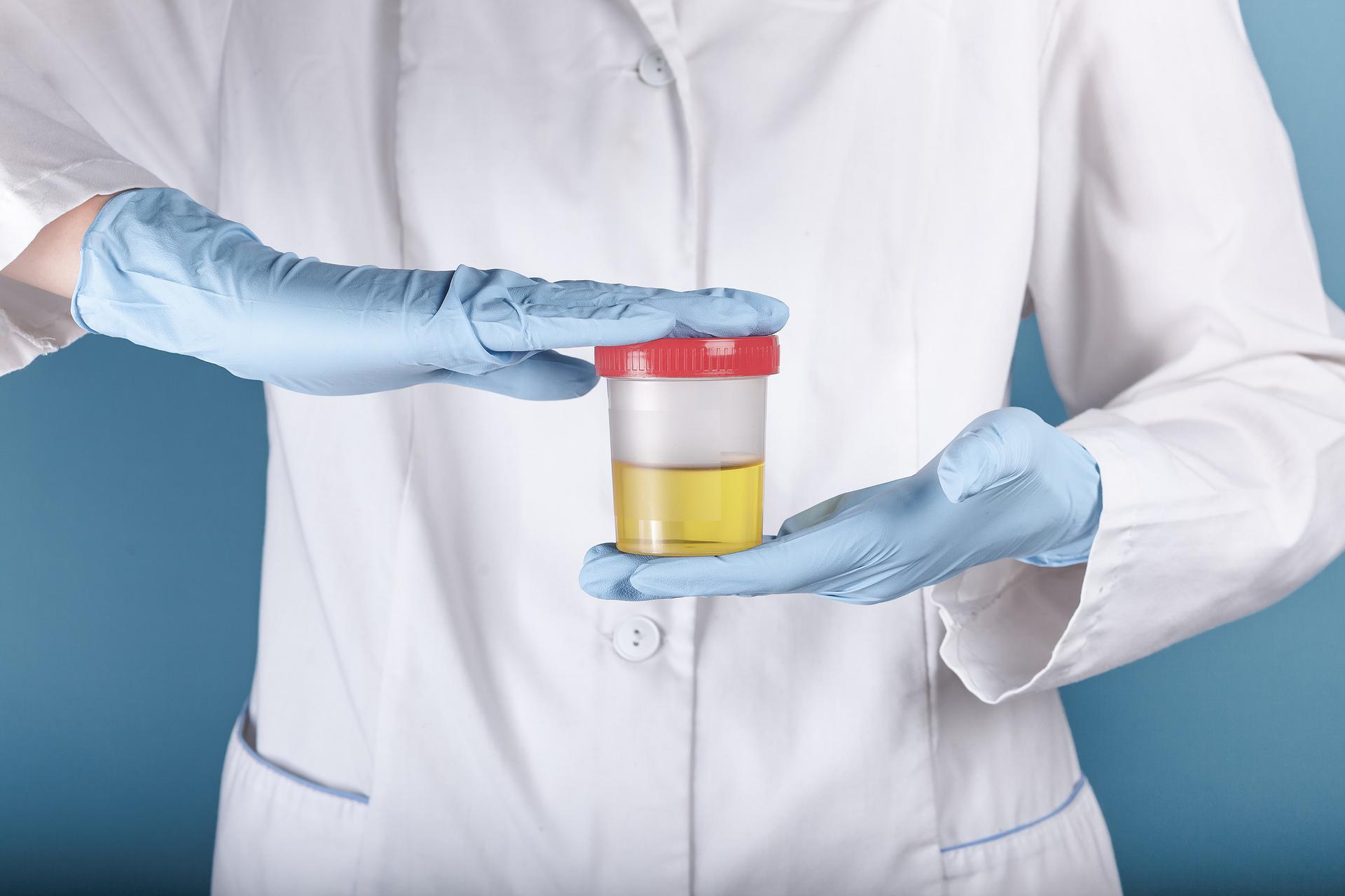 What is Employment Drug Testing - featured