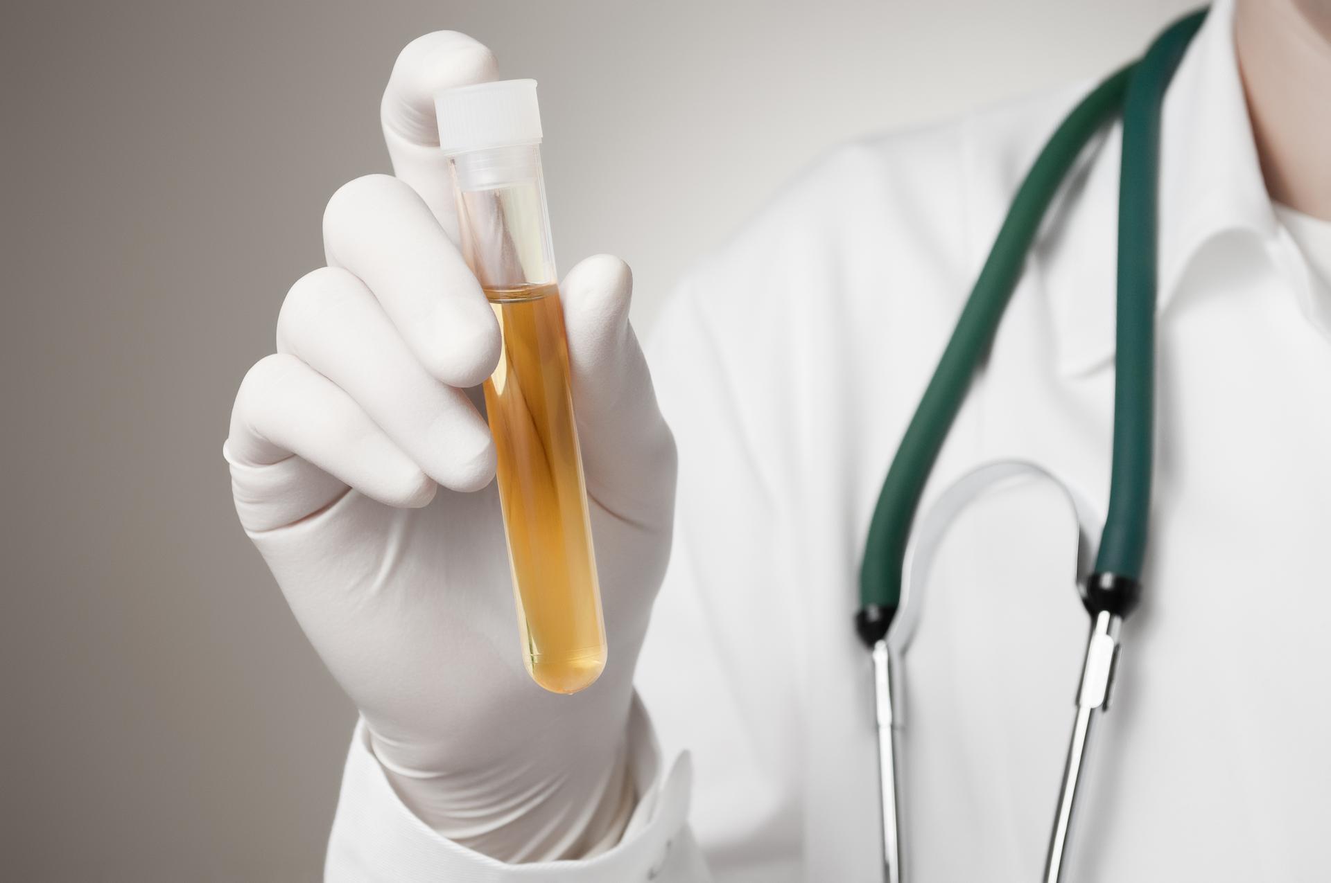 Why is Drug Testing Necessary in the Workplace - featured