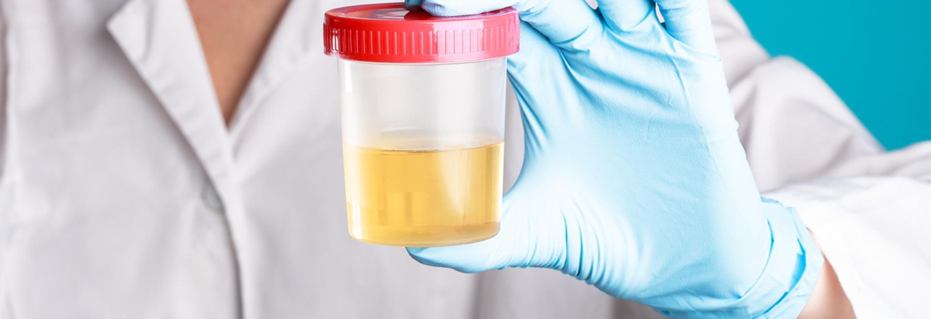 Drug Testing – Frequently Asked Questions - info-hero