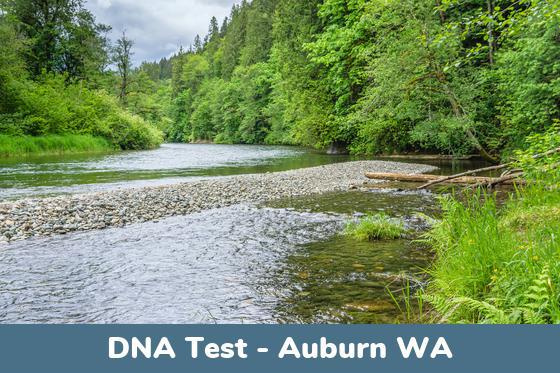 Auburn WA DNA Testing Locations