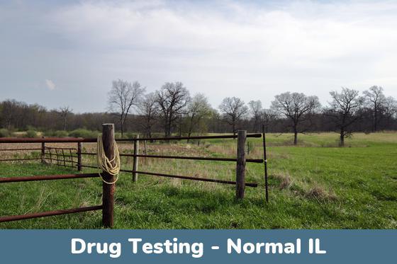 Normal IL Drug Testing Locations